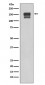 Anti-Integrin beta 1 ITGB1 Rabbit Monoclonal Antibody